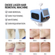 Best sale  OPT IPL Machine Hair Removal Device IPL Laser Portable Machine