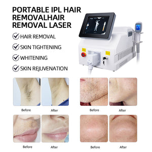 Trending Products 2023 Diode Laser 808 Diode Laser Hair Removal Machine